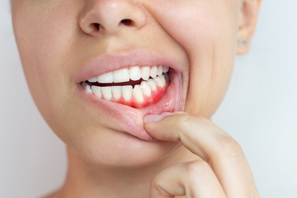 When To Visit A Periodontist For Gum Recession